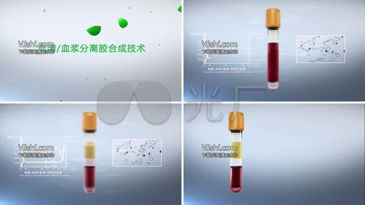 血液,血浆,血清 怎么分别?
