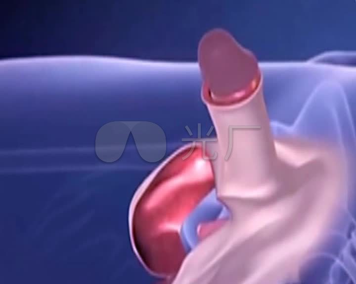 动画展示男变女的性器官_720x576_高清视频素材下载