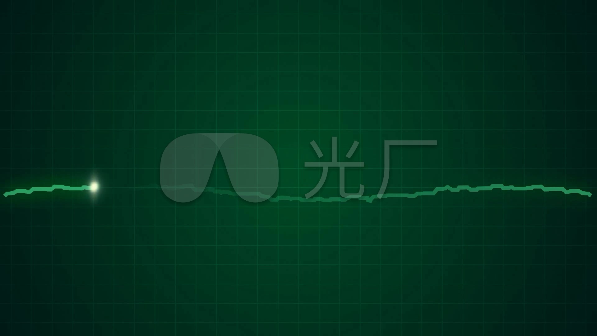 心脏病患者心电图
