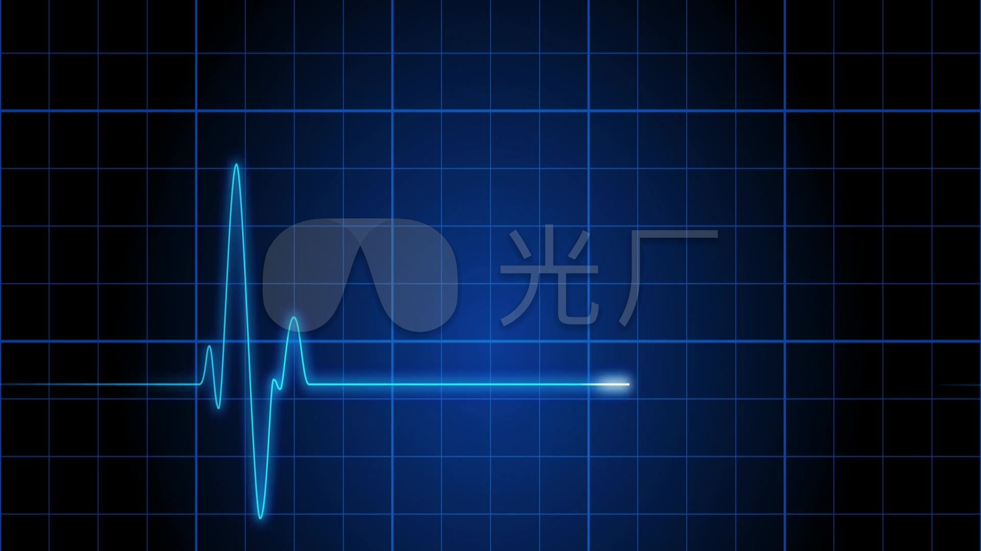 心电图股票视频