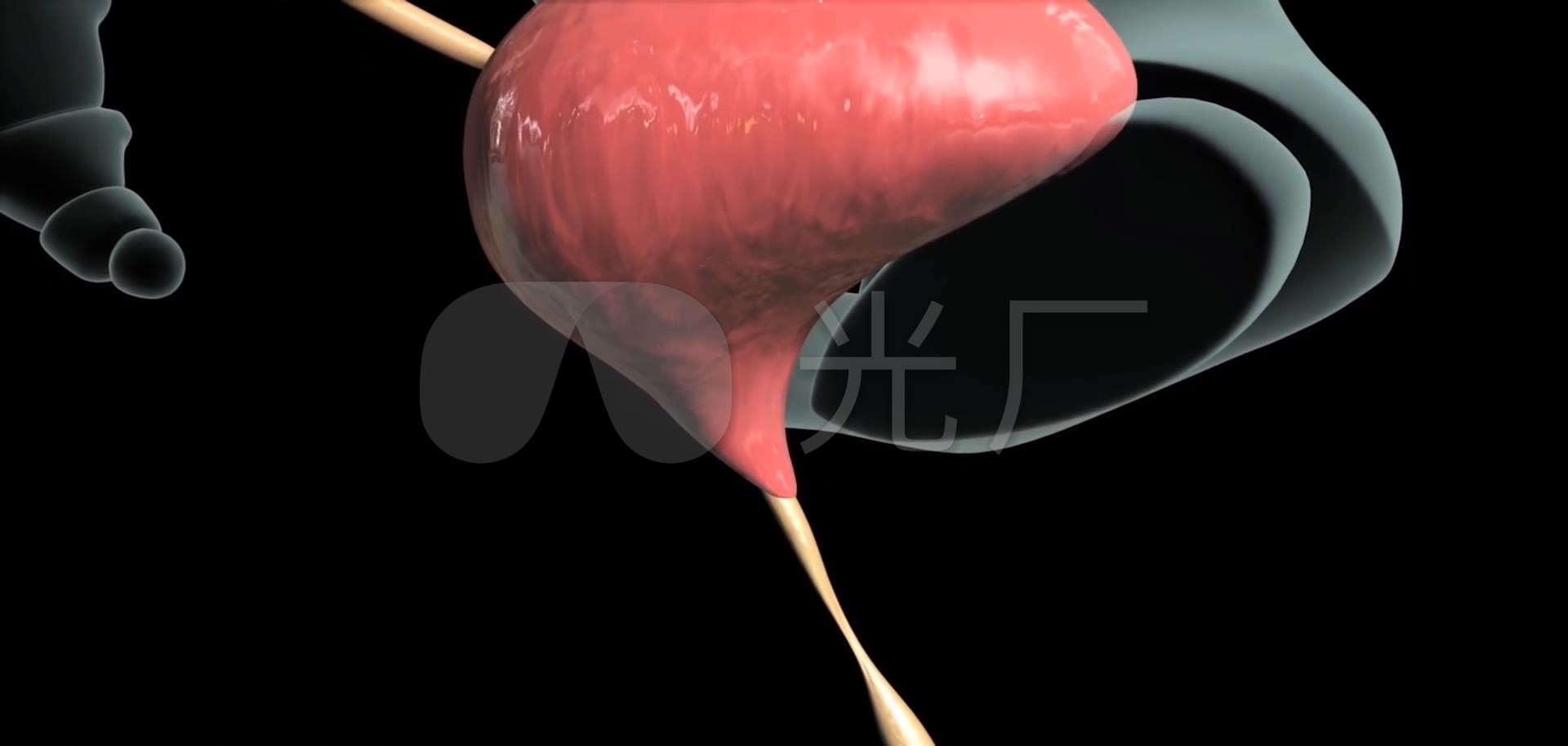 3D膀胱镜检查技术泌尿系统医疗视频_1920X9