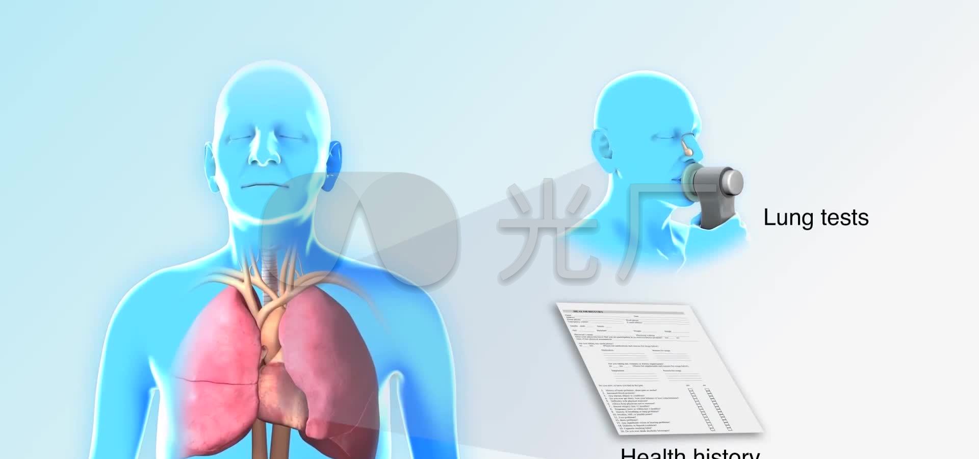 3d肺康复医疗视频