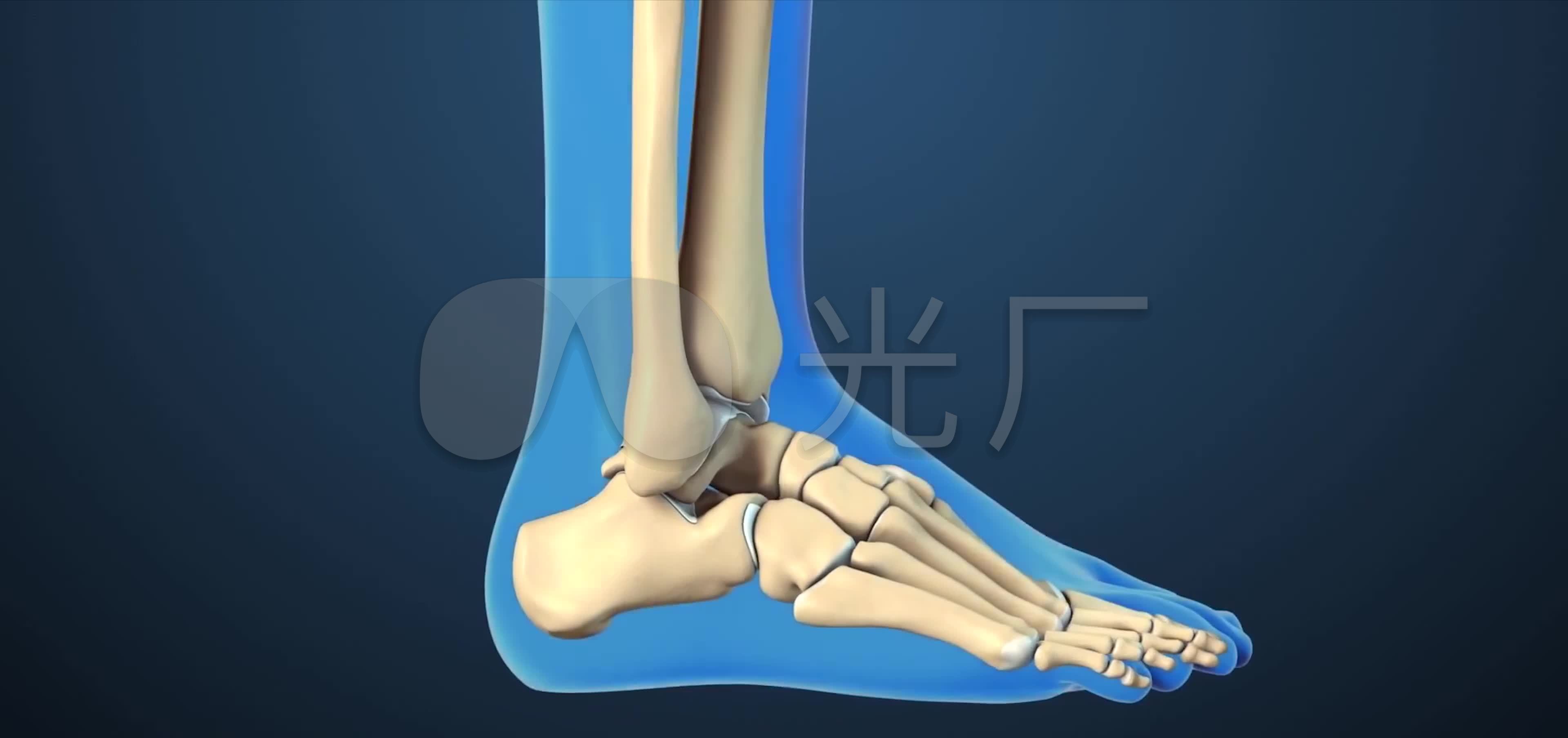 3D关节炎全踝关节置换手术医疗视频_3840X1