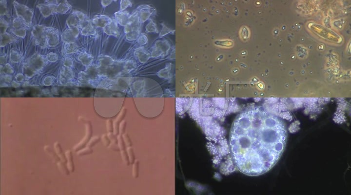 医学医药微生物细胞显微镜下观察合集