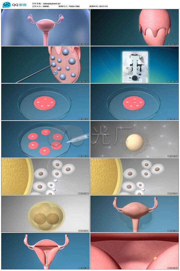 3d医学人工授精授孕动画演示过程