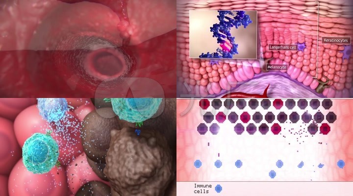 保健护理生命微生物科技科研癌细胞转移医学动画病变肌理病理