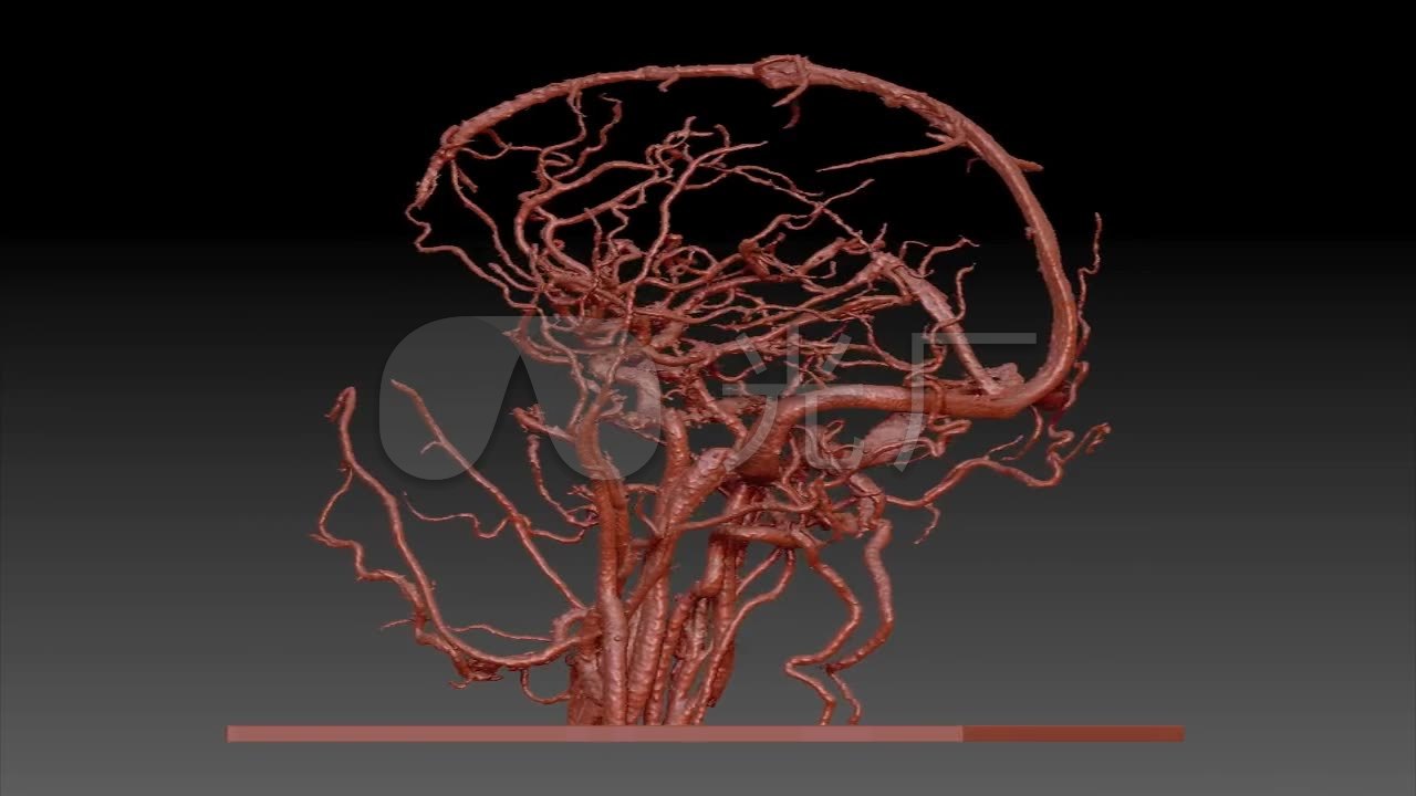 脑血管医疗医学生物学_1280X720_高清视频素材下载(编号:1952546)_实拍视频
