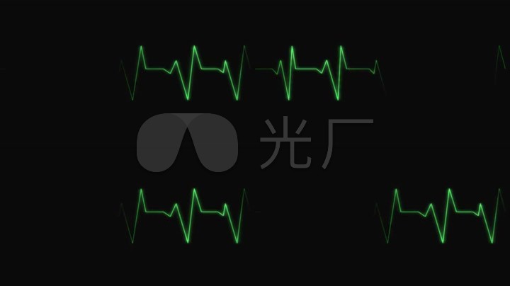 心跳脉搏心电图波动电波