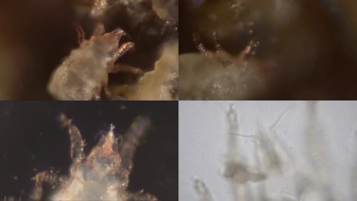 倍显微镜下的微生物微观世界生物细菌生物学微生物寄生虫实拍视频螨虫