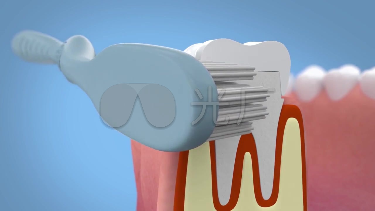 牙齿清洁洗牙三维医疗动画