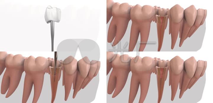 3d医疗牙科牙医牙齿牙齿动画牙齿健康