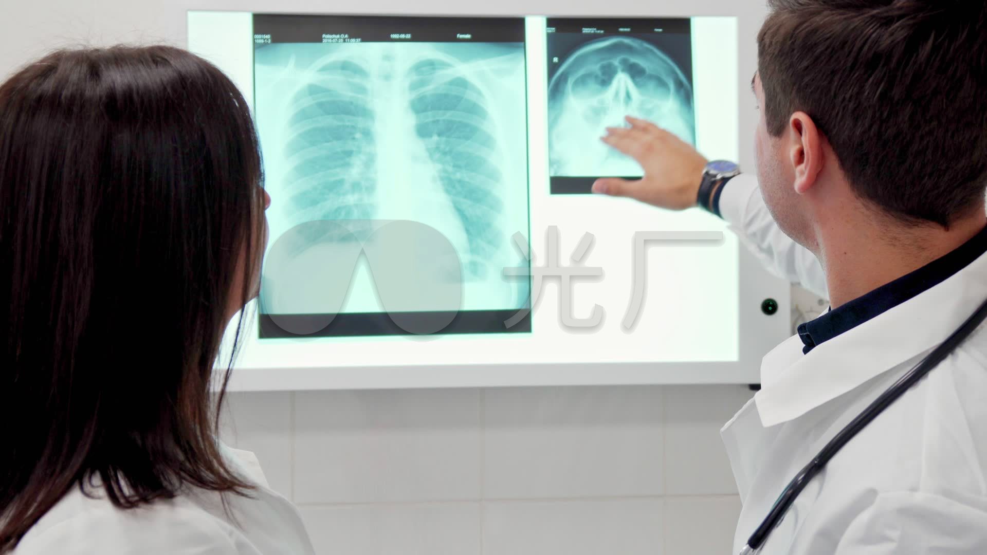 胸片医院医疗_1920x1080_高清视频素材下载(编号:3029589)_实拍视频