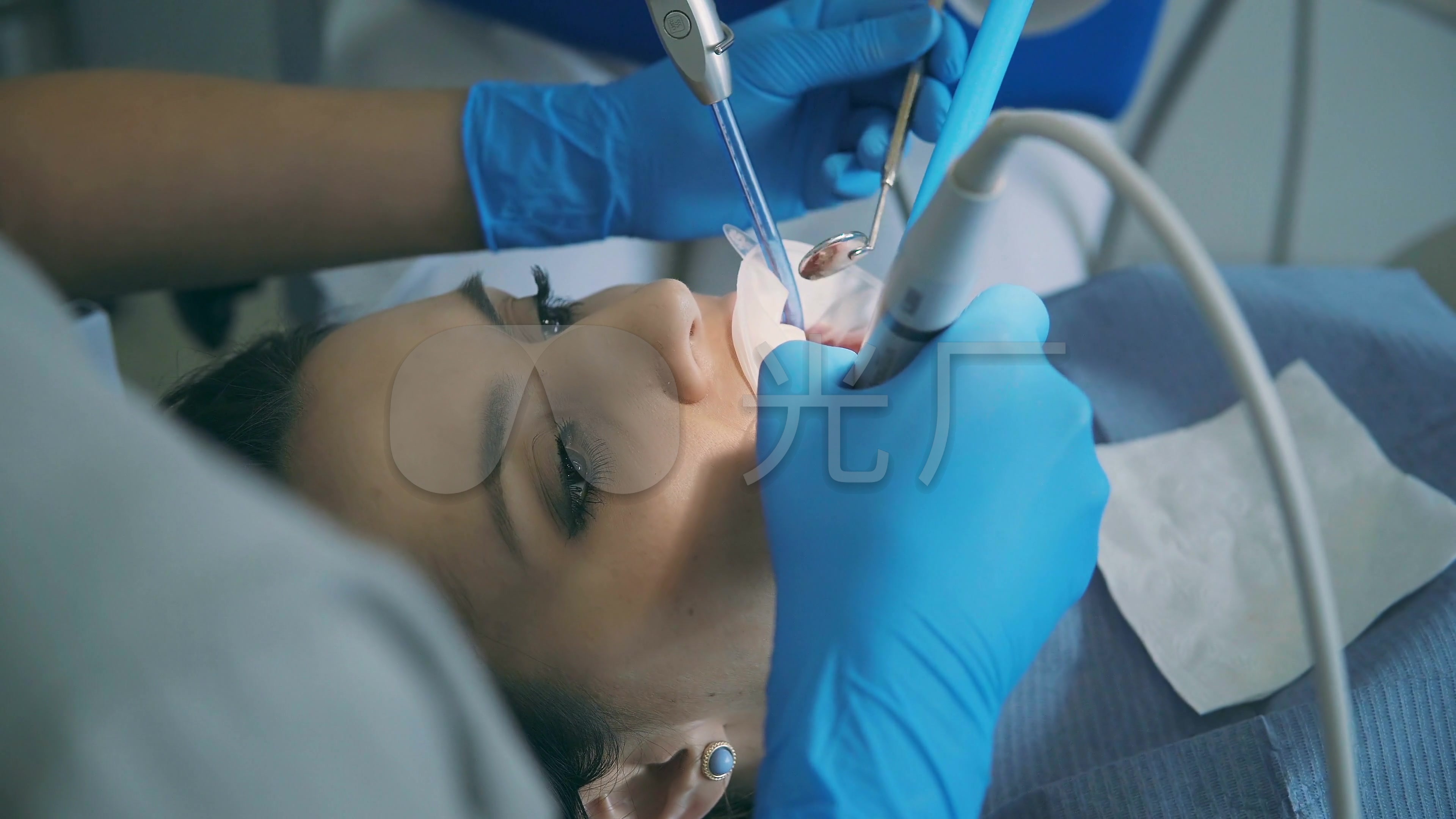 牙科牙医牙科手术牙齿手术