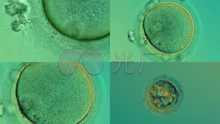 显微镜下精子与卵子结合_细胞受精怀孕实拍