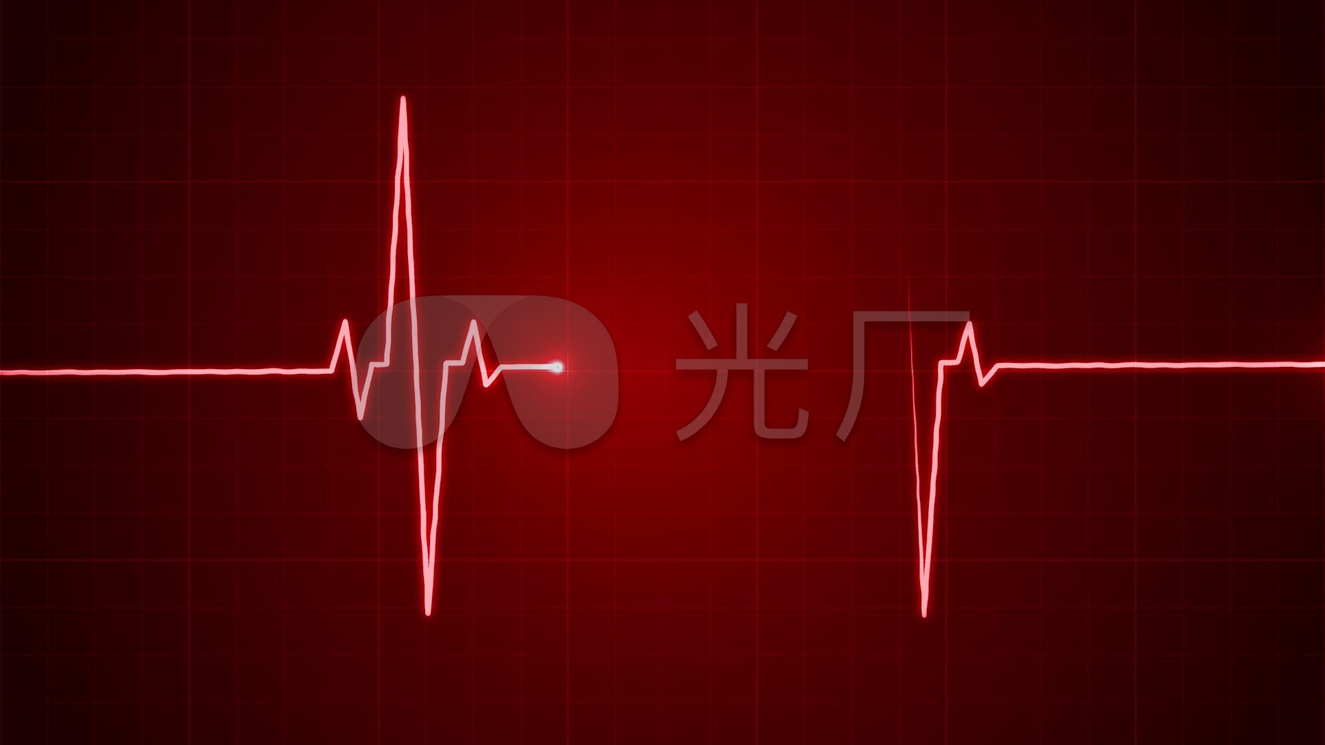 心电图
