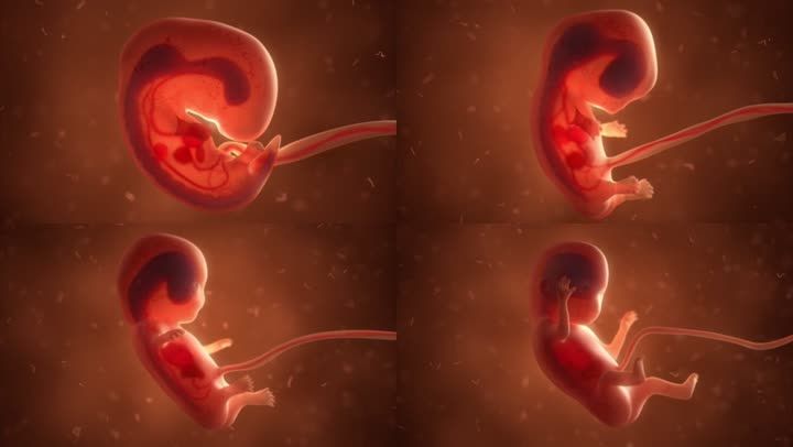 寄生胎图片一_印度一女婴体内有8个寄生胎_小康康寄生胎