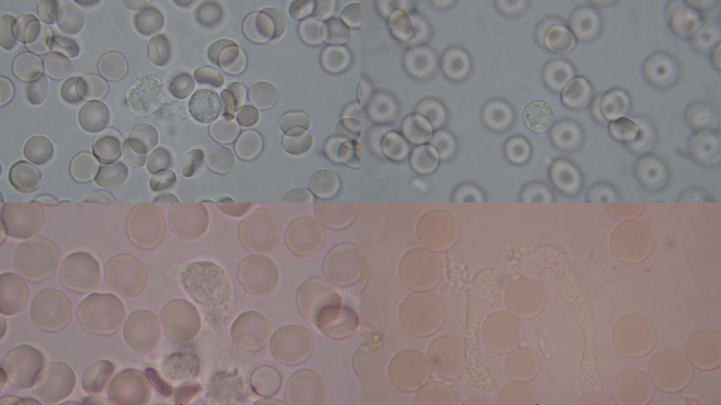 显微镜下白细胞