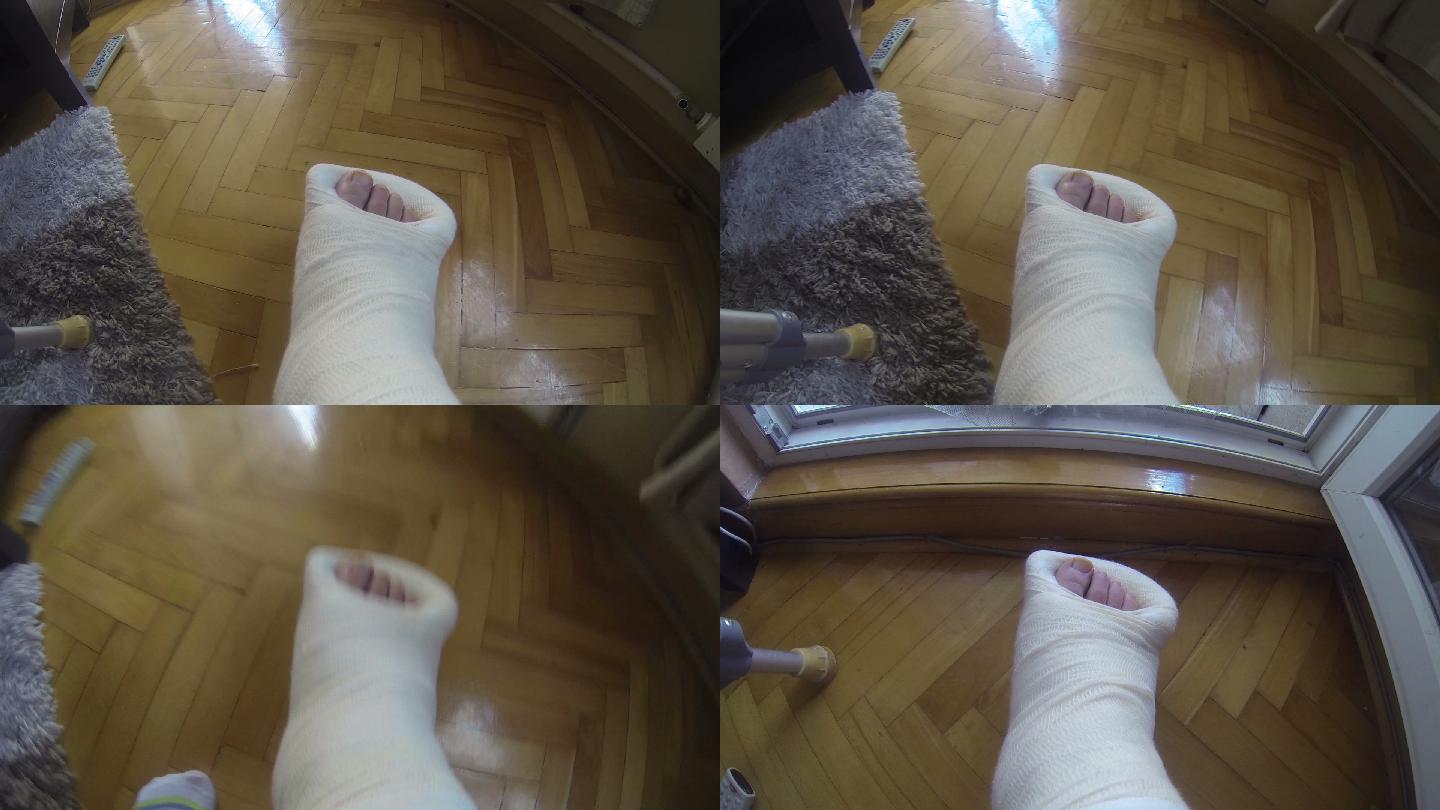 键盘左右键也可以翻页哟画质举报 护理骨科石膏残疾保险拐杖石膏骨折
