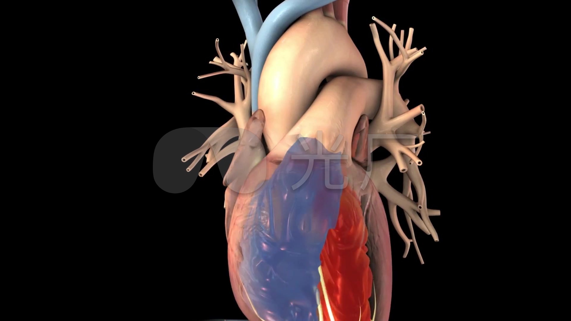 视频素材 实拍视频 医疗教育 心脏治疗心脏手术3d三维动画 来自视频