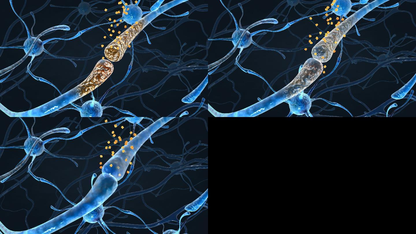 非入侵性治疗激活神经肽再生完成神经肽在
