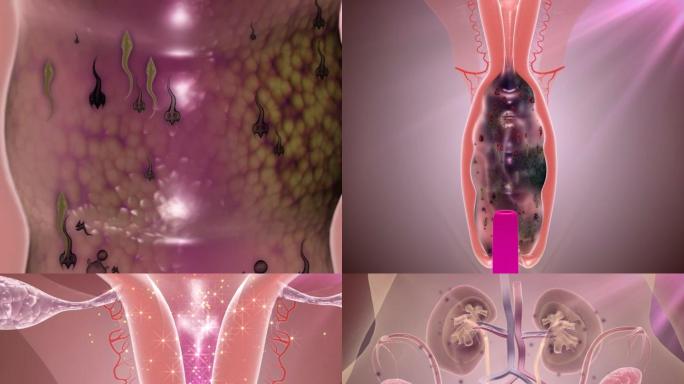 医疗医学类女性生殖系统三维动画演示