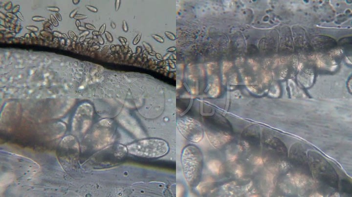 显微镜下的细菌微生物_1280X720_高清视频素
