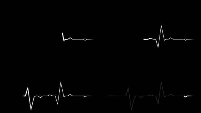 带通道心电图心脏动画