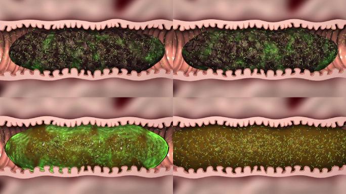 肠道机理肠道分解宿便