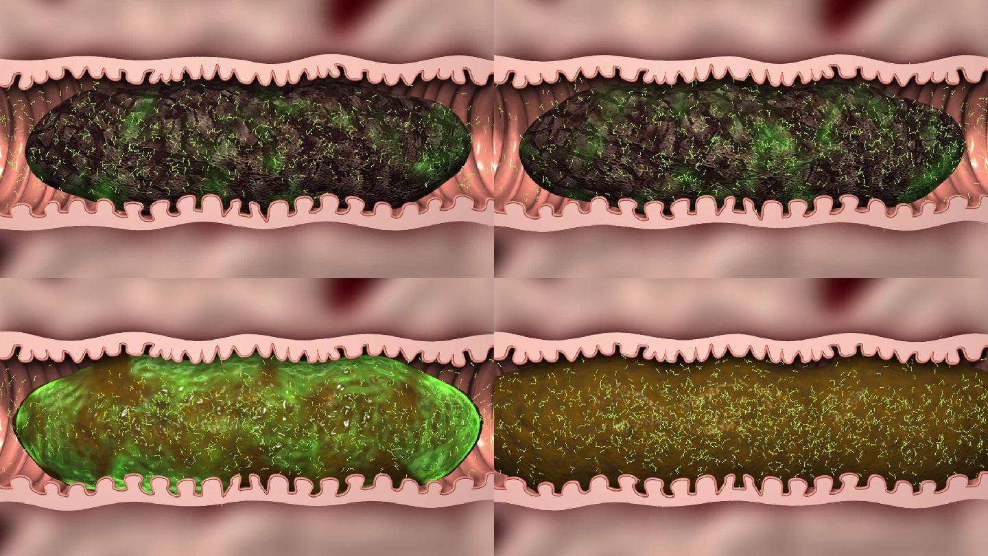 肠道机理肠道分解宿便