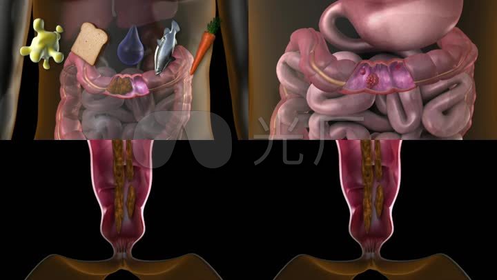 3D医疗人体肠胃大肠小肠肠道肠癌_1920X108