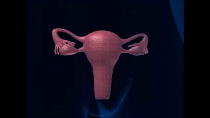 子宫三维模型