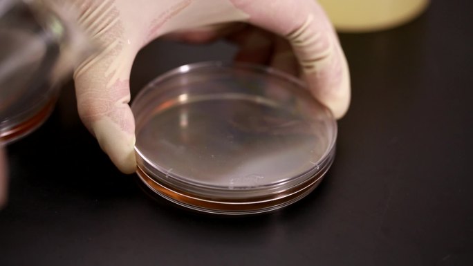 科学检验烧杯细菌培养病菌检测