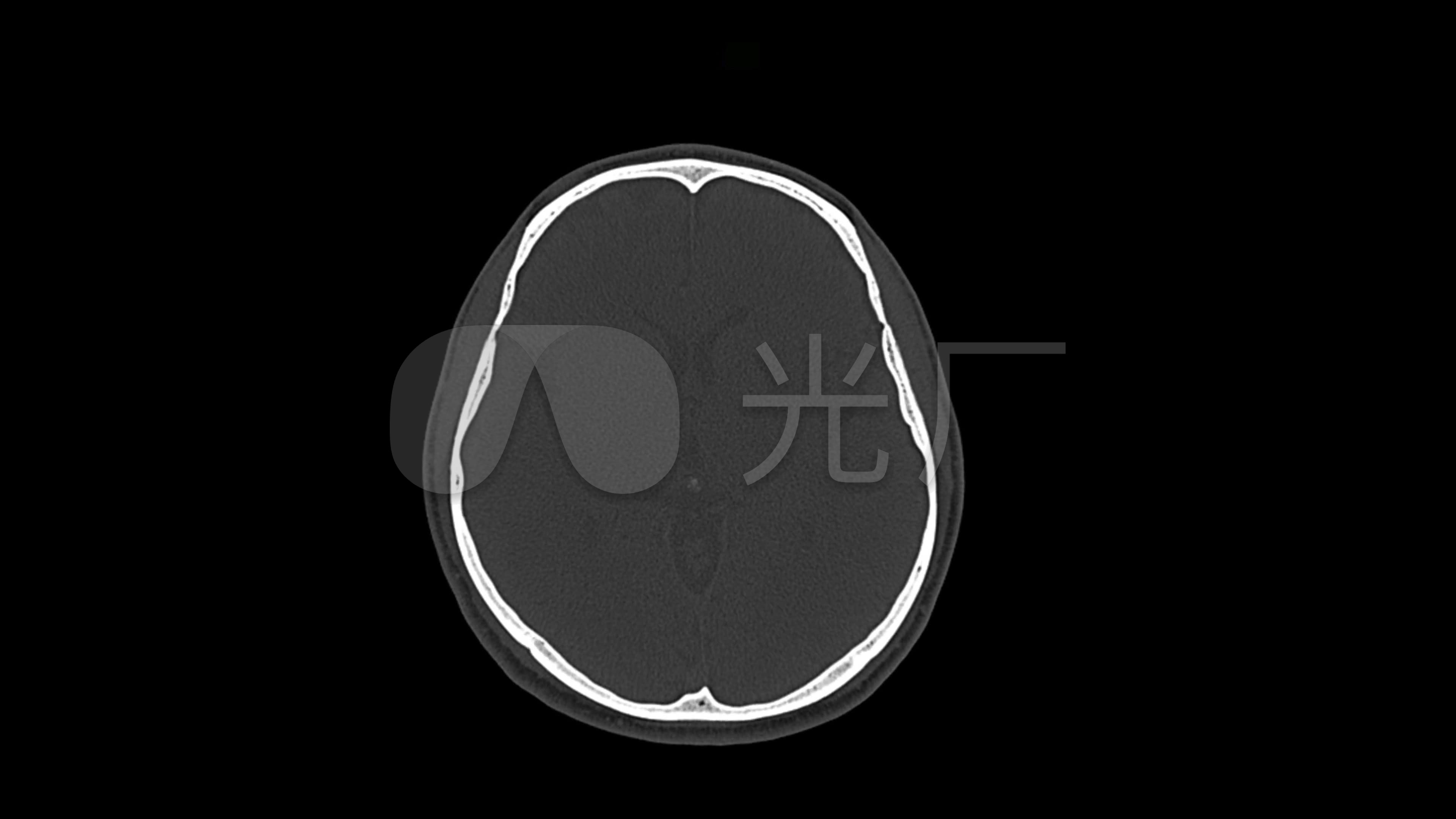 視頻素材 實拍視頻 醫療教育 x光片診斷頭骨透視骨科 來自視頻原始