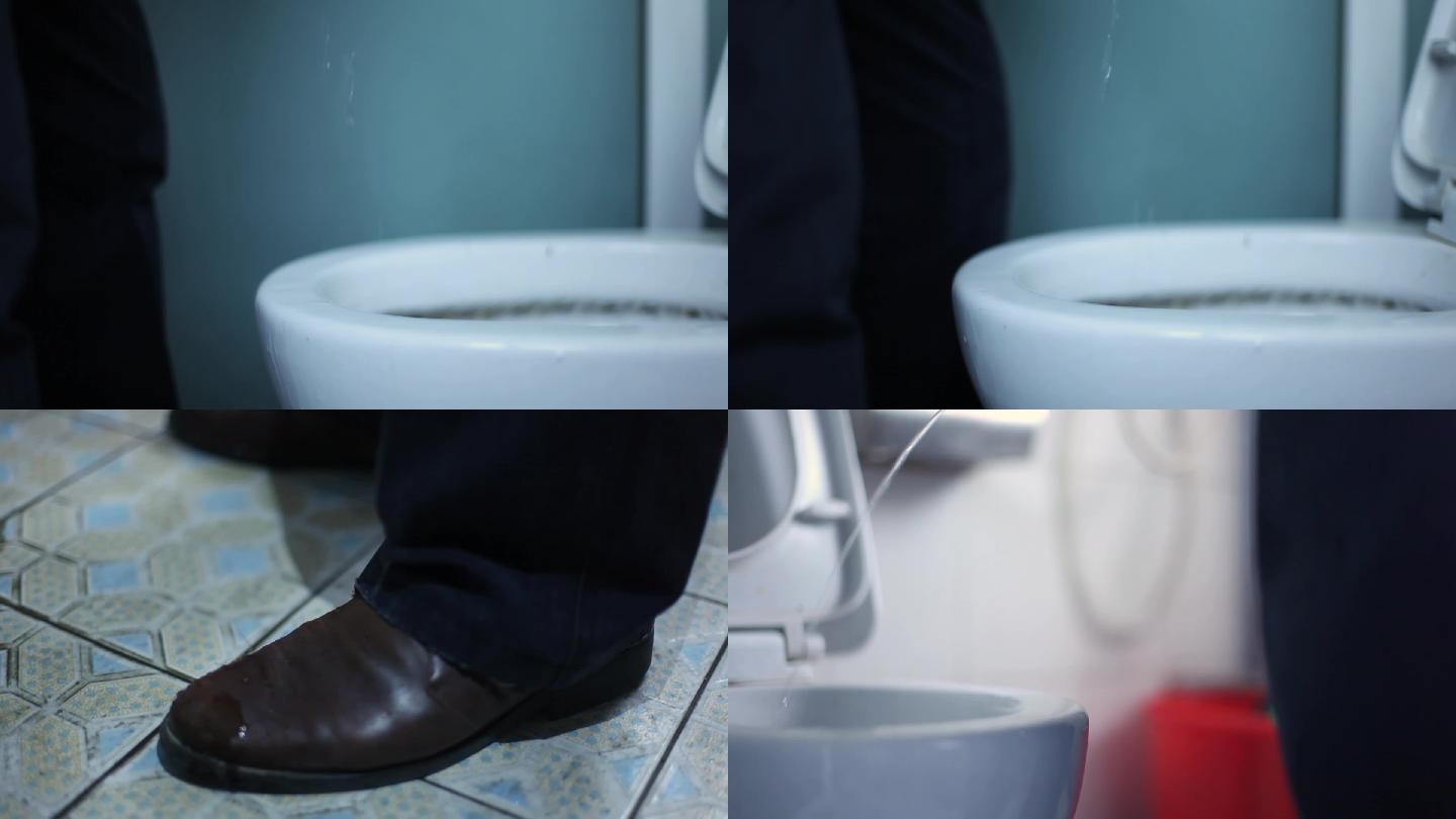 尿分叉尿滴沥前列腺疾病