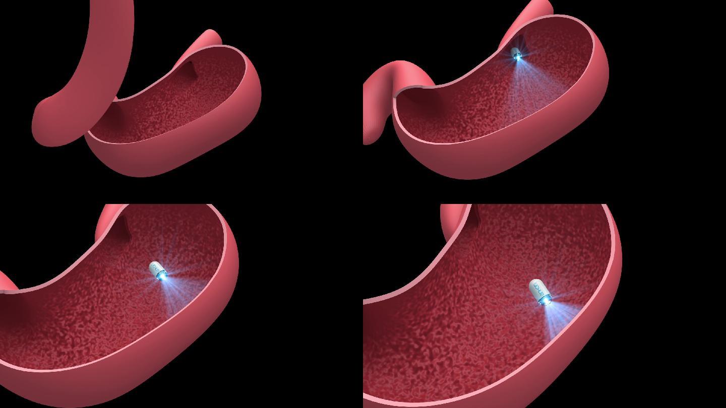 胃部胶囊体检检查三维动画c4d模型