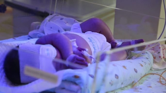 照蓝光的新生儿早产儿在保温箱中的宝宝