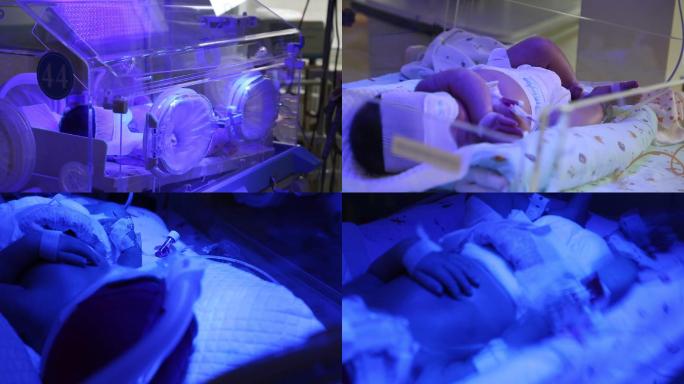 照蓝光的新生儿早产儿在保温箱中的宝宝