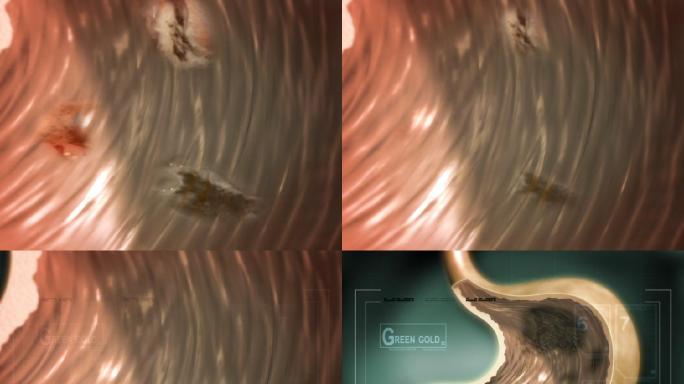 医学疾病医疗生物医学广告医药