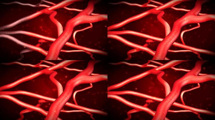 软化血管改善血管微循环