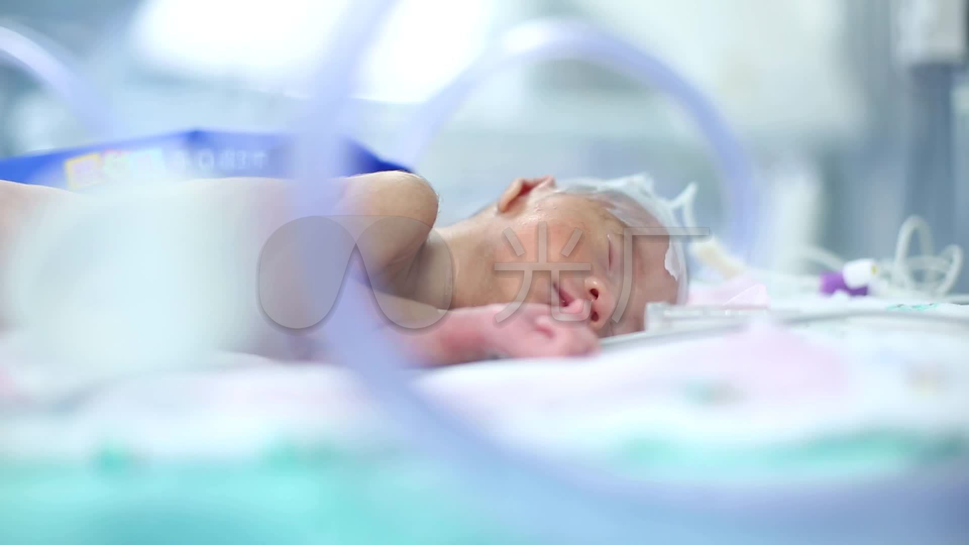 Child in intensive care unit after heart surgery. Shallow depth of ...