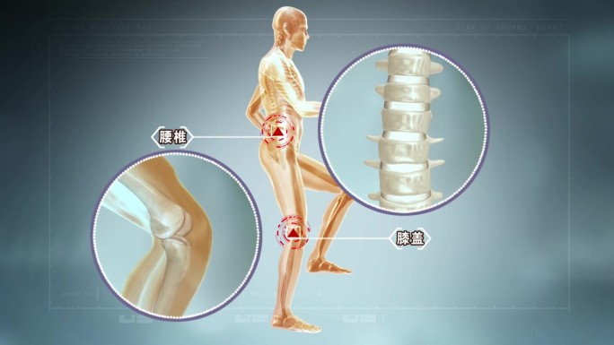 腰椎病三维演示动画