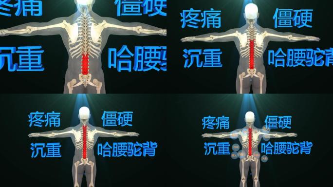 背部损伤带来的问题