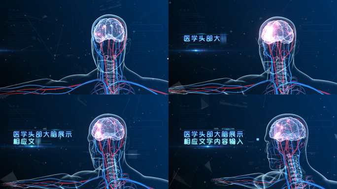 医学大脑展示AE模板