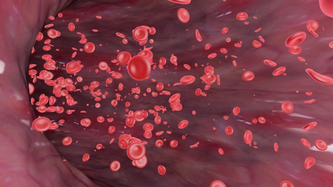 血红蛋白细胞堵塞疏通