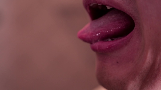 舌头舌苔脸皮肤青春痘痤疮长痘