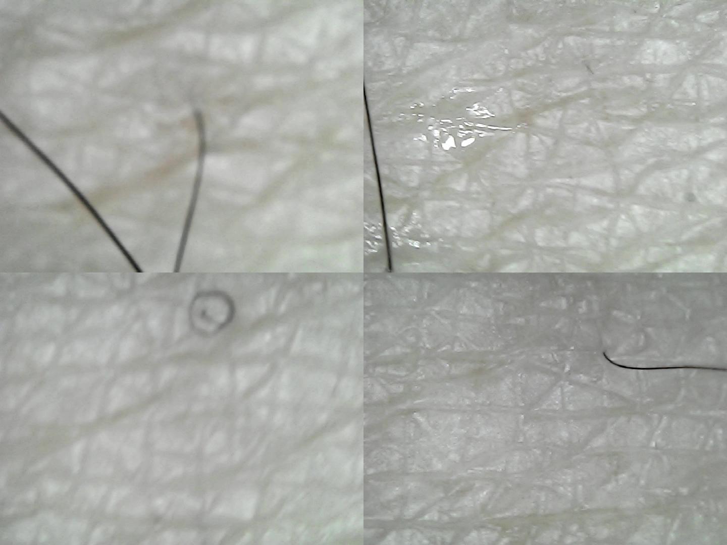 显微镜特写放大镜微观人体毛发