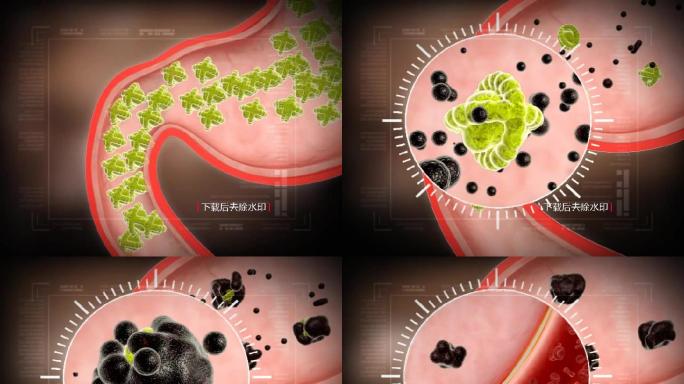 肾炎药物分子治疗肾病