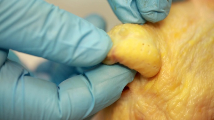 鸡肉白条鸡免疫系统免疫器官脾脏