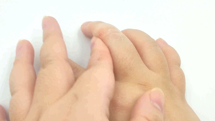 手手指4k皮肤皮炎破损炎症