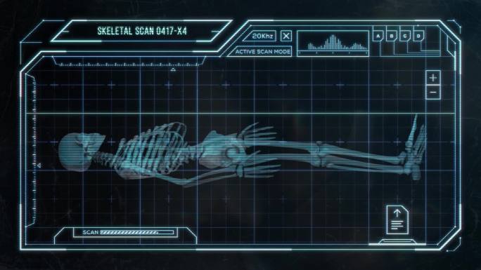 骨骼头部骨骼透视医疗扫描